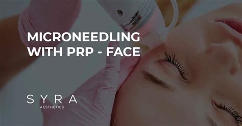 prp microneedling redwood city  It’s typically done to improve the appearance of scars and increase collagen production